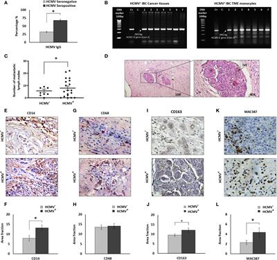 Inflammatory Breast Cancer: The Secretome of HCMV+ Tumor-Associated Macrophages Enhances Proliferation, Invasion, Colony Formation, and Expression of Cancer Stem Cell Markers